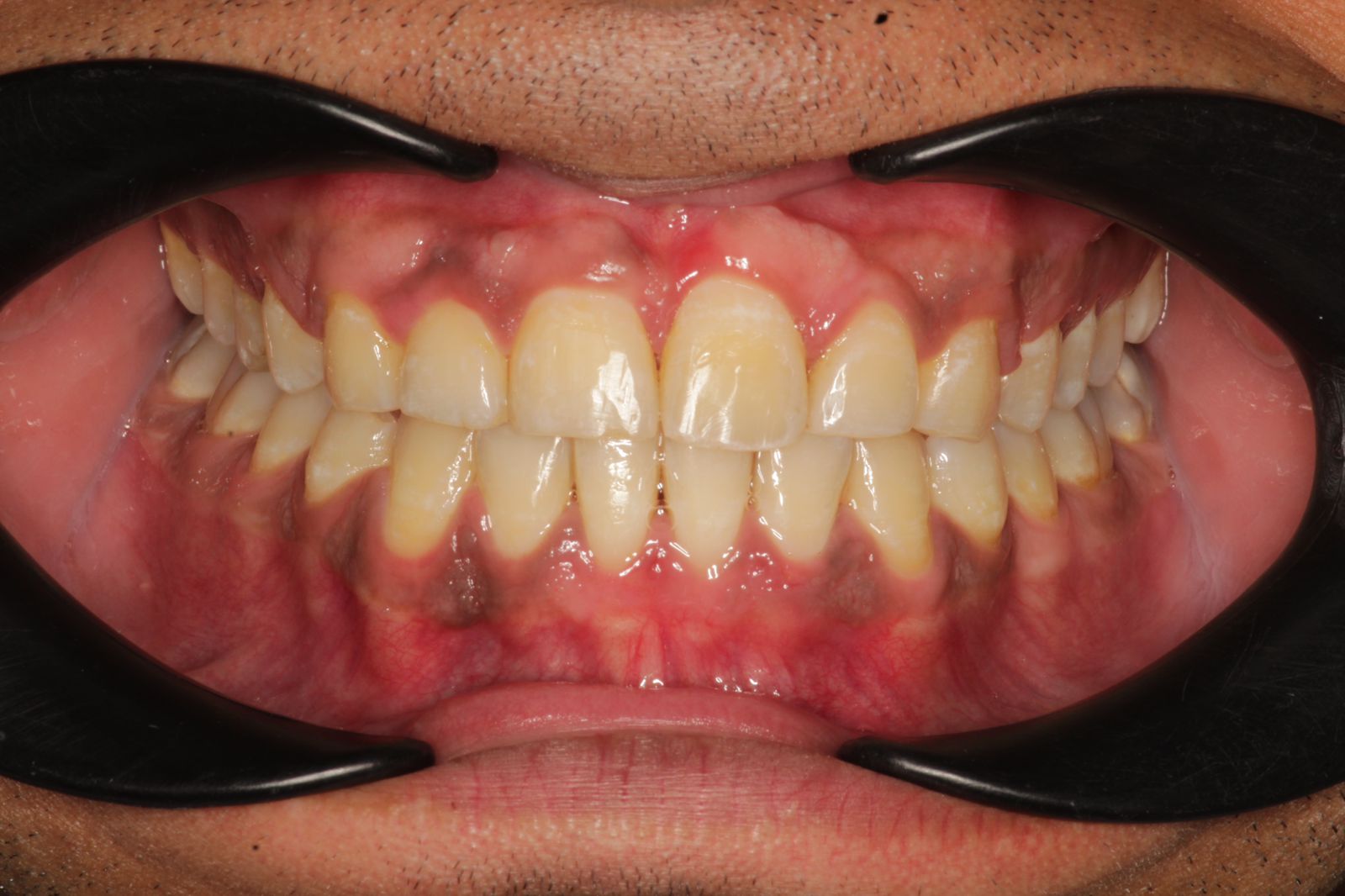 transformation-img-2