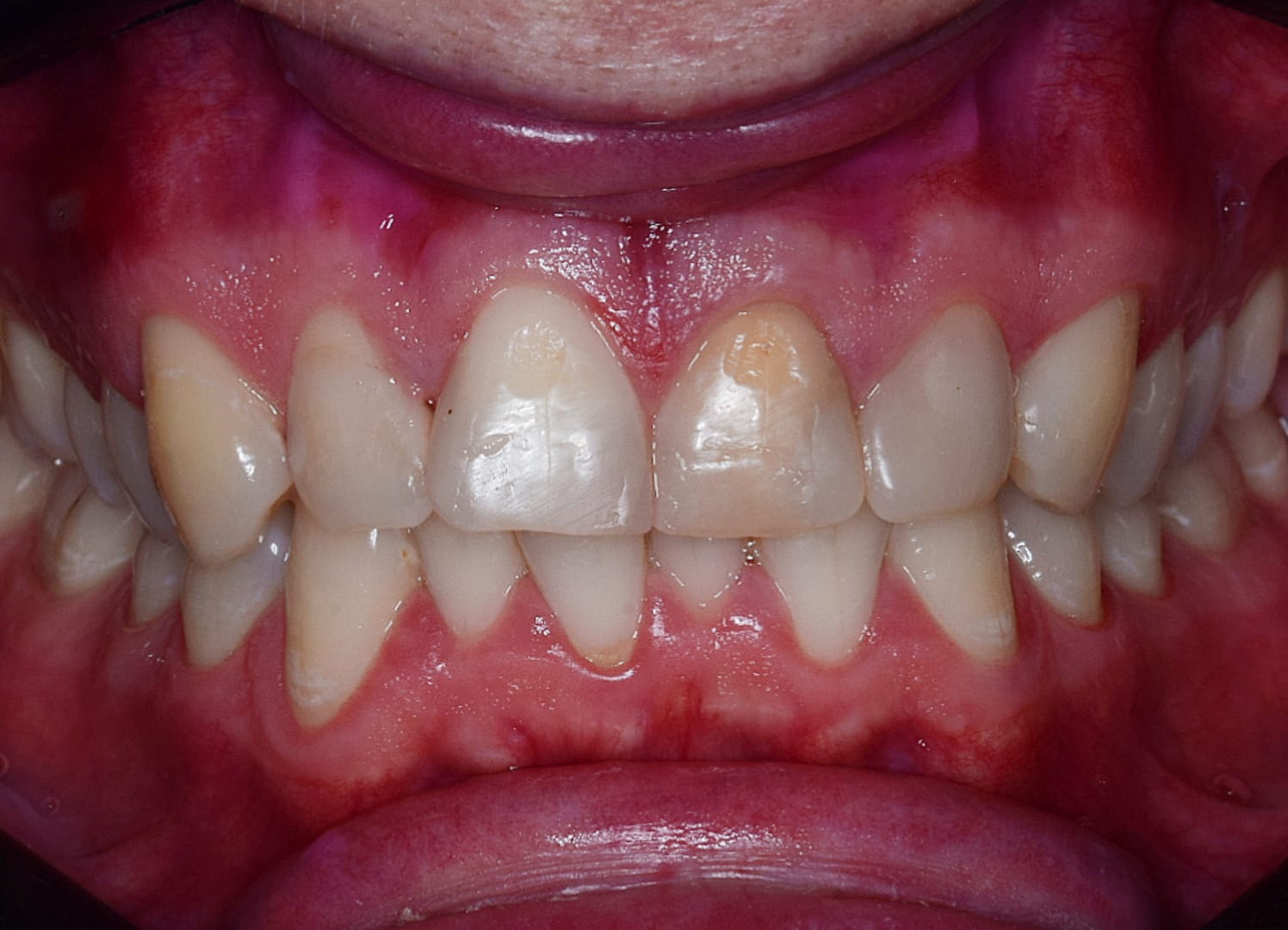 transformation-img-1