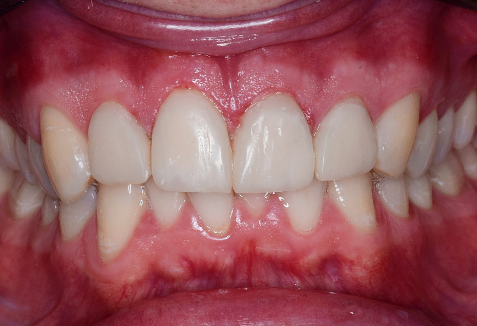 transformation-img-2