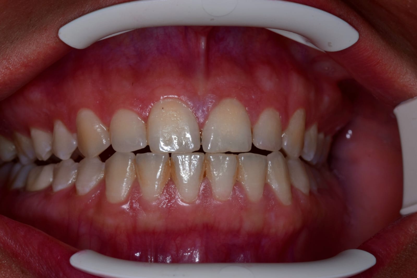 transformation-img-1