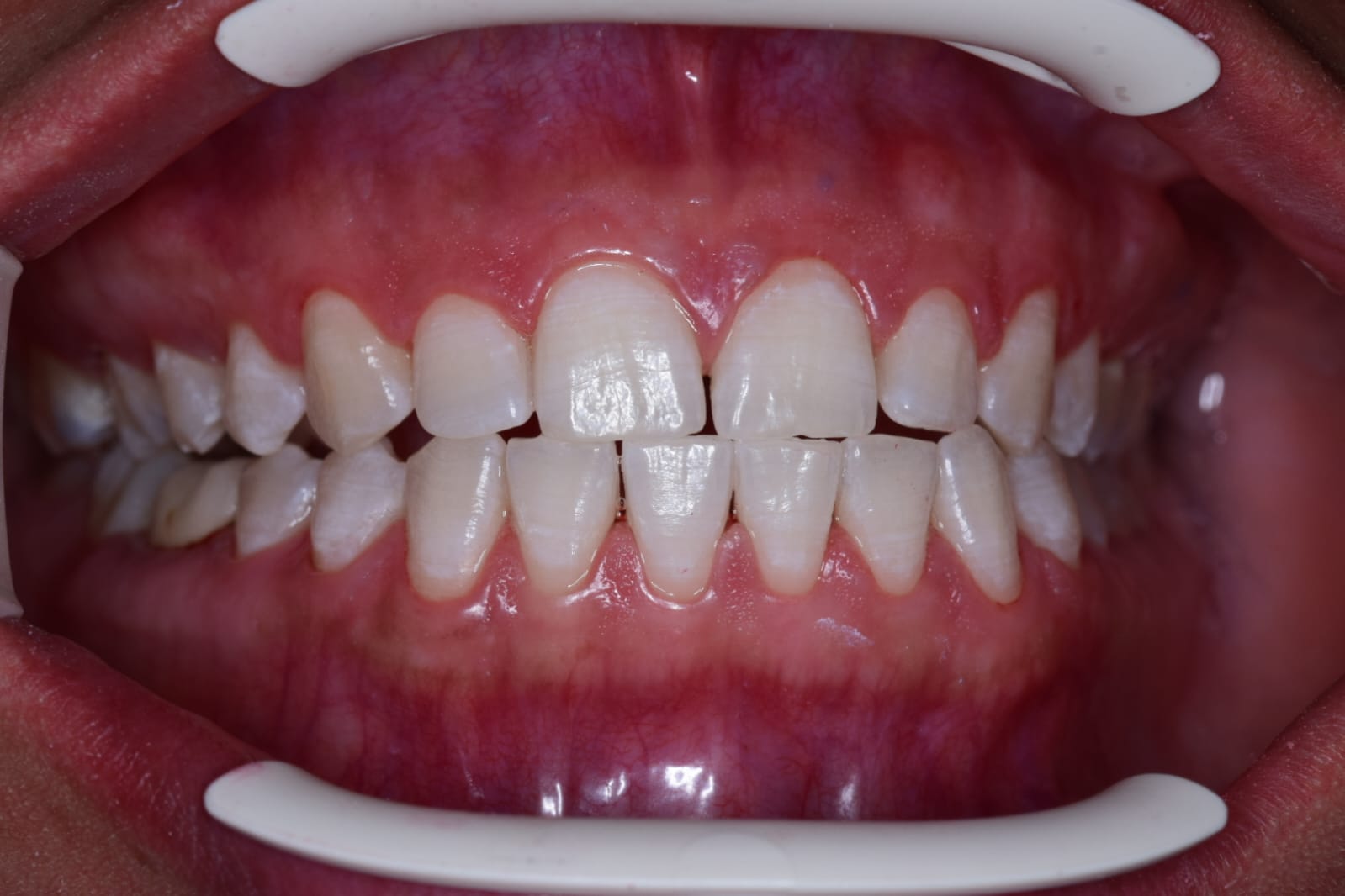 transformation-img-2